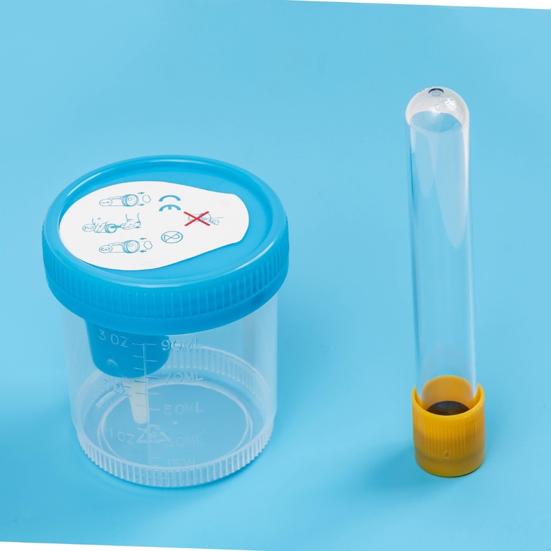 Factory Direct China Disposable Urine Specimen Blue Sample Collection Cup – Urine Container and Vacuum Tube